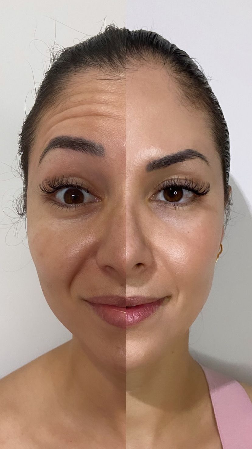 Antes e depois — caso 5